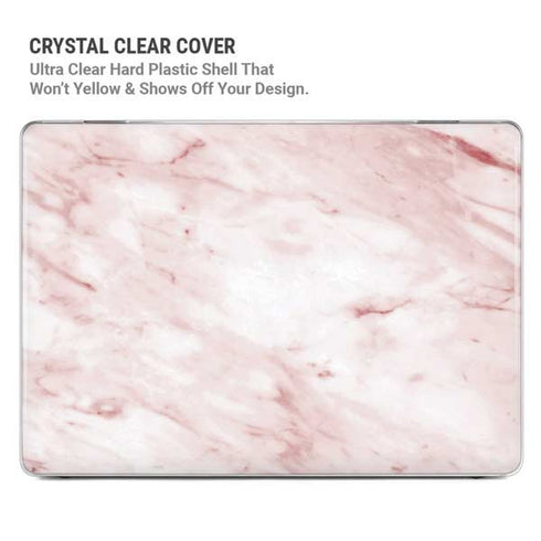 Pink Marble MacBook Pro 14in (2021-24) Case plus Skin